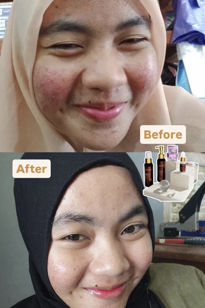 Dokumentasi skincare pelanggan
